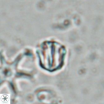Catinaster coalitus 26699