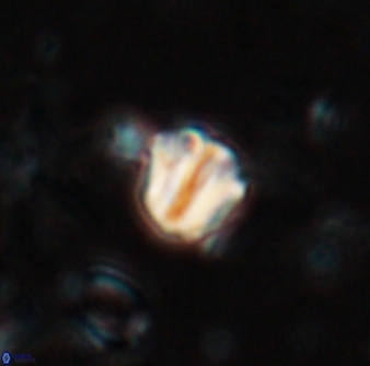 Catinaster coalitus 26693