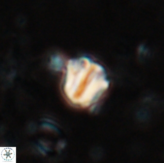 Catinaster coalitus 26693