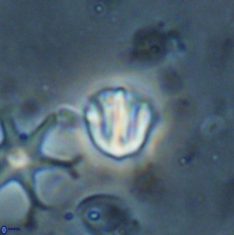 Catinaster coalitus 26701