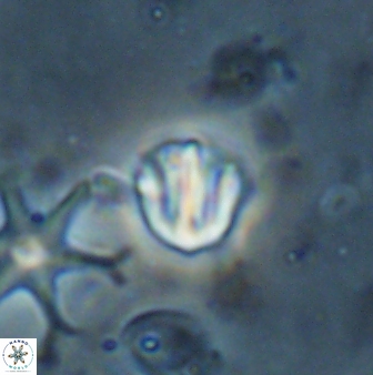 Catinaster coalitus 26701