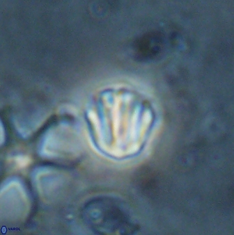 Catinaster coalitus 26702