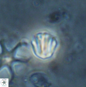 Catinaster coalitus 26702