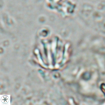Catinaster coalitus 26834