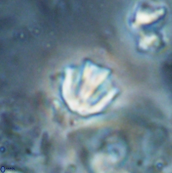 Catinaster coalitus 26839
