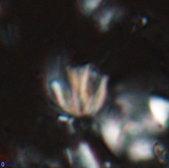 Catinaster coalitus 26844