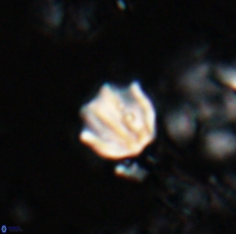 Catinaster coalitus 26846