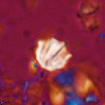 Catinaster coalitus 26842