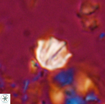 Catinaster coalitus 26842