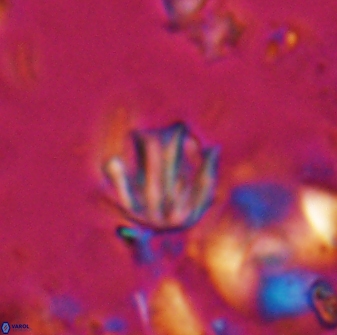Catinaster coalitus 26843