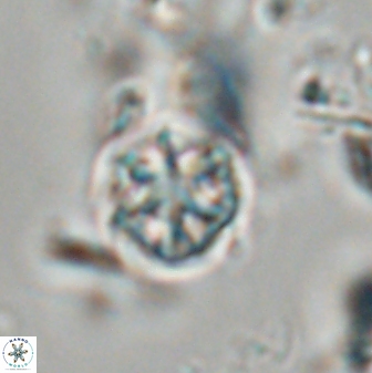 Catinaster coalitus 29256