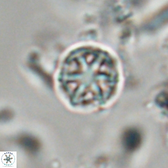 Catinaster coalitus 29258