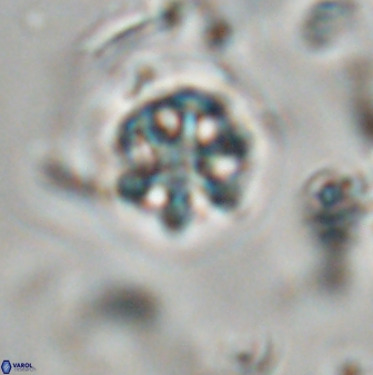 Catinaster coalitus 29259