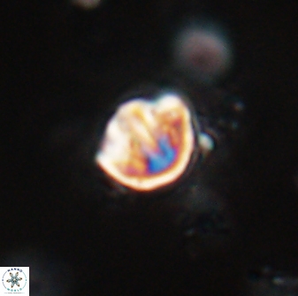 Catinaster coalitus 29250