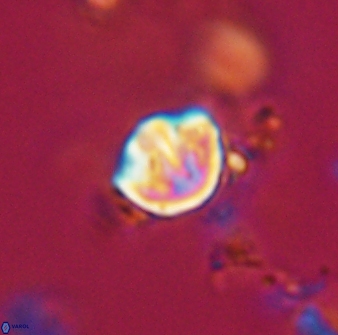 Catinaster coalitus 29251