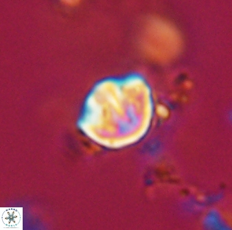 Catinaster coalitus 29251
