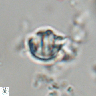 Catinaster coalitus 29253