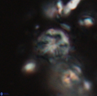 Catinaster coalitus 29264