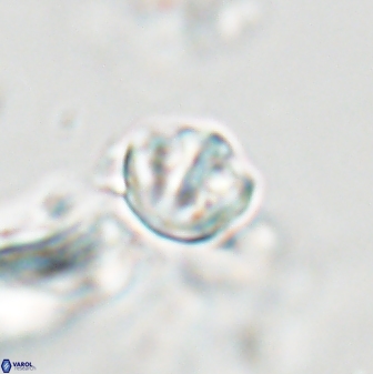 Catinaster coalitus 29267