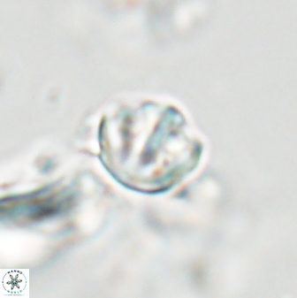 Catinaster coalitus 29267