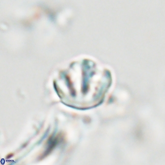Catinaster coalitus 29268