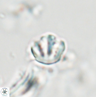 Catinaster coalitus 29268