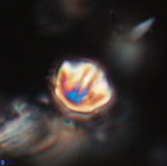Catinaster coalitus 29269
