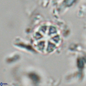 Catinaster coalitus 29262