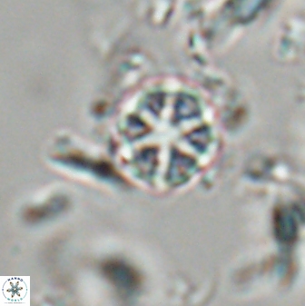 Catinaster coalitus 29262