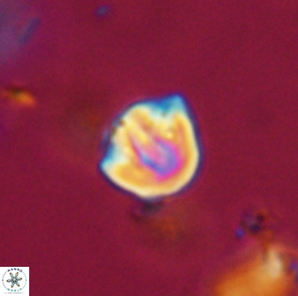 Catinaster coalitus 29314
