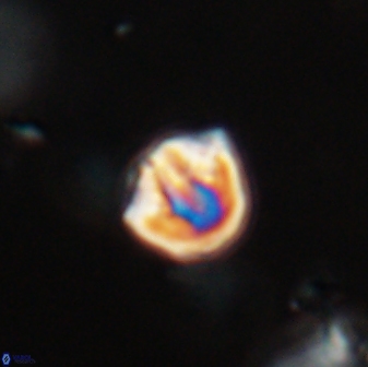 Catinaster coalitus 29315