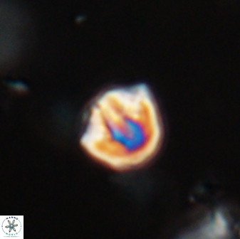 Catinaster coalitus 29315