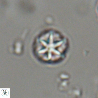 Catinaster coalitus 29317