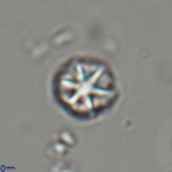 Catinaster coalitus 29318