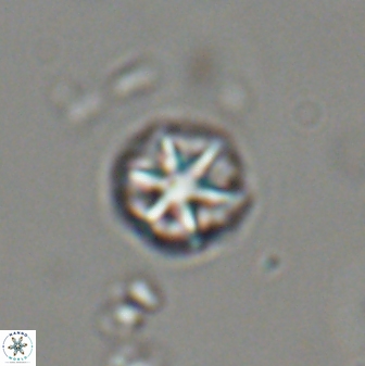 Catinaster coalitus 29318