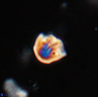 Catinaster coalitus 29312