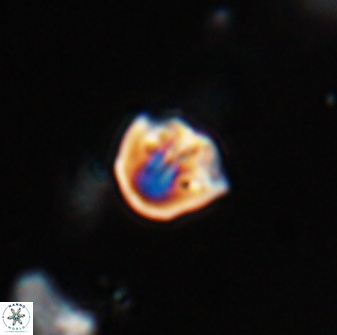 Catinaster coalitus 29312