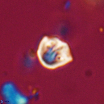 Catinaster coalitus 29313