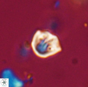 Catinaster coalitus 29313