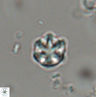 Catinaster coalitus 29321
