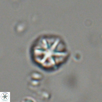 Catinaster coalitus 29322