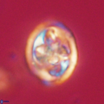 Caulophorolithus sigmoides 65054