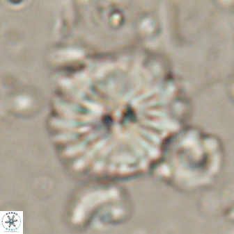Caycedoa atlanticus 53794