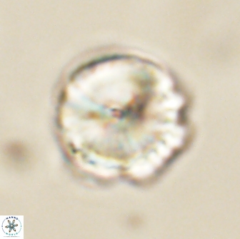 Caycedoae conicus 66742