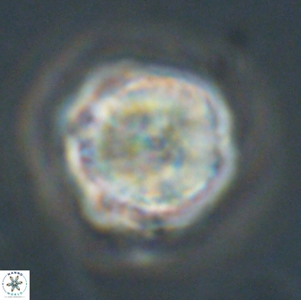 Caycedoae conicus 66745