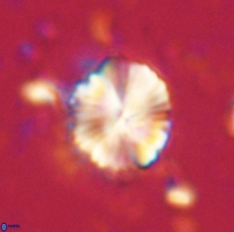 Caycedoae atlanticus 62812