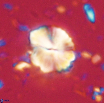 Caycedoae atlanticus 62815