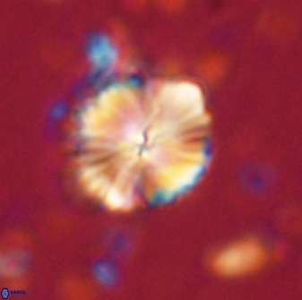 Caycedoae atlanticus 62816