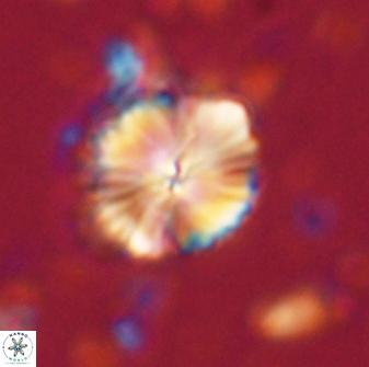 Caycedoae atlanticus 62816