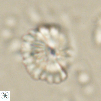 Caycedoae atlanticus 62823